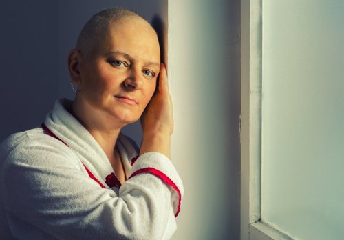 Hair loss: Breast cancer side effects