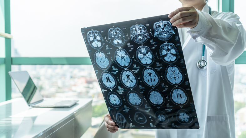 Doctor examining the scans of a patient with a brain injury