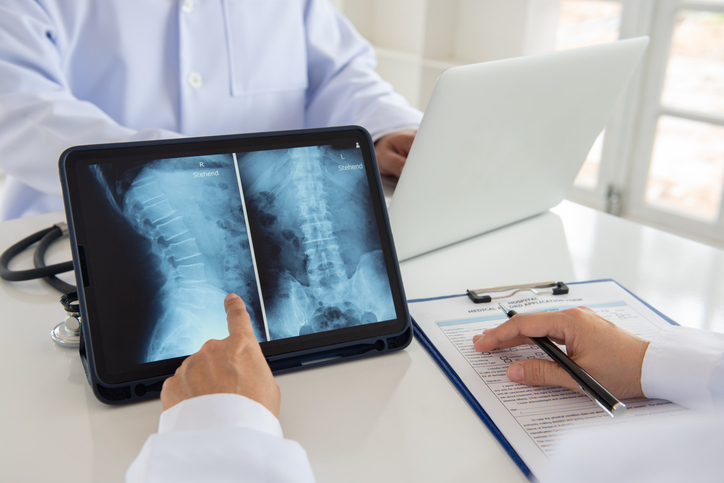spinal cord injury lawyer