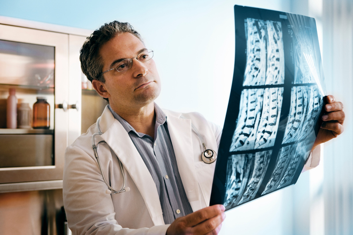 doctor in white coat holds up spinal cord xray to examine