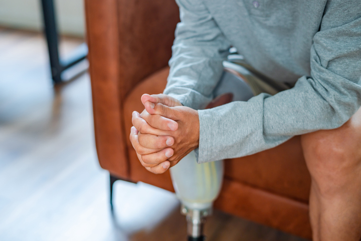amputation injury lawyer